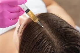 PRP hair treatment consultation in Birmingham