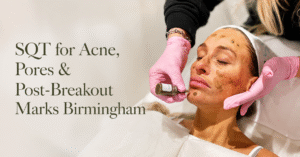 Is SQT Bio-Microneedling Good for Acne, Pores and Post-Breakout Marks