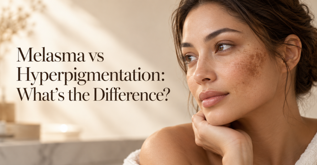 Melasma vs Hyperpigmentation_ Skincare Guide